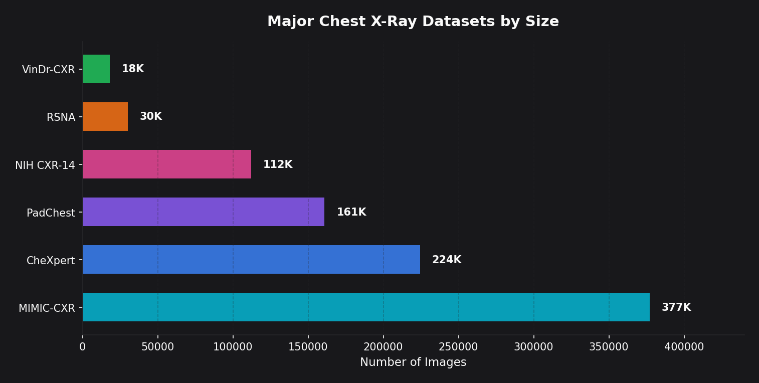 Major Chest X-Ray Datasets by Size: MIMIC-CXR 377K, CheXpert 224K, PadChest 161K, NIH CXR-14 112K